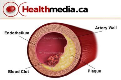 Test Ultram And Menstrual Cramps a factor affecting the type of questions being asked.