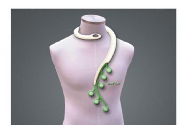 aorta