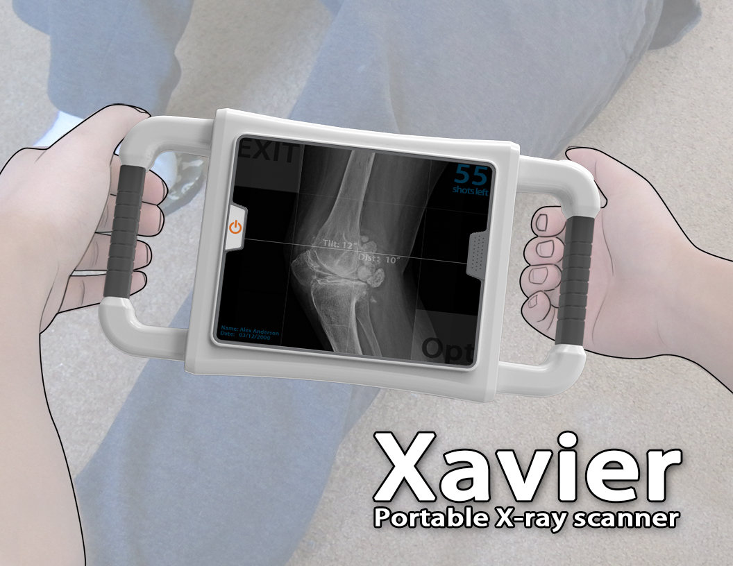 Portable X Ray Machine - Best Photos HD