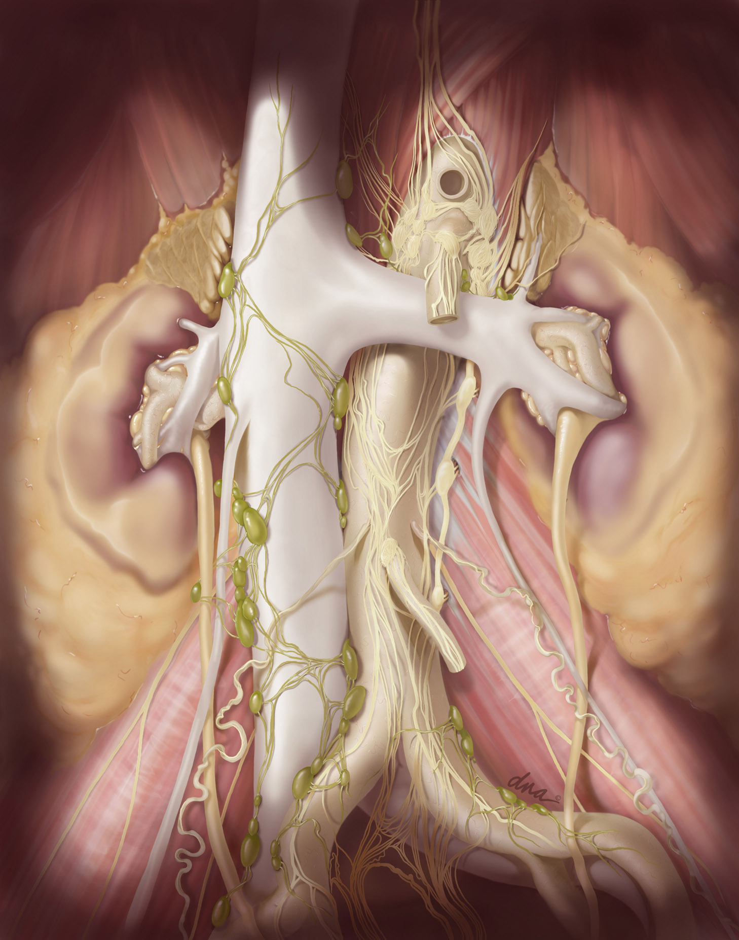 Retroperitoneal Lymph Node Dissection by Alexandra Baker at Coroflot.com