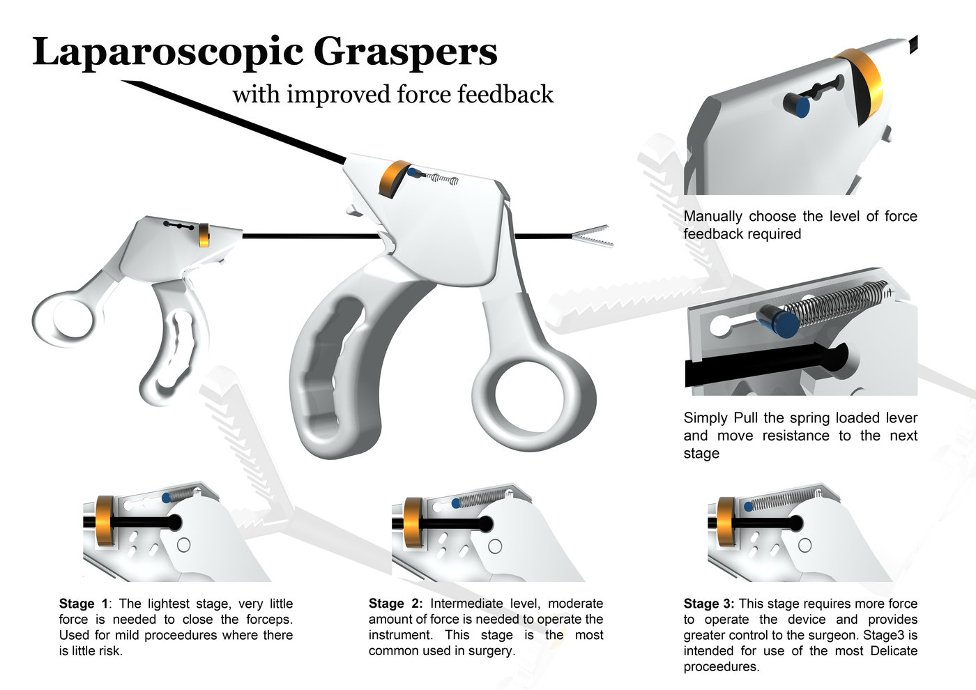 Laparoscopic Graspers by Ian Leonard at