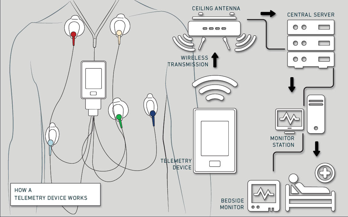 Telemetry Device by Casey Maul at