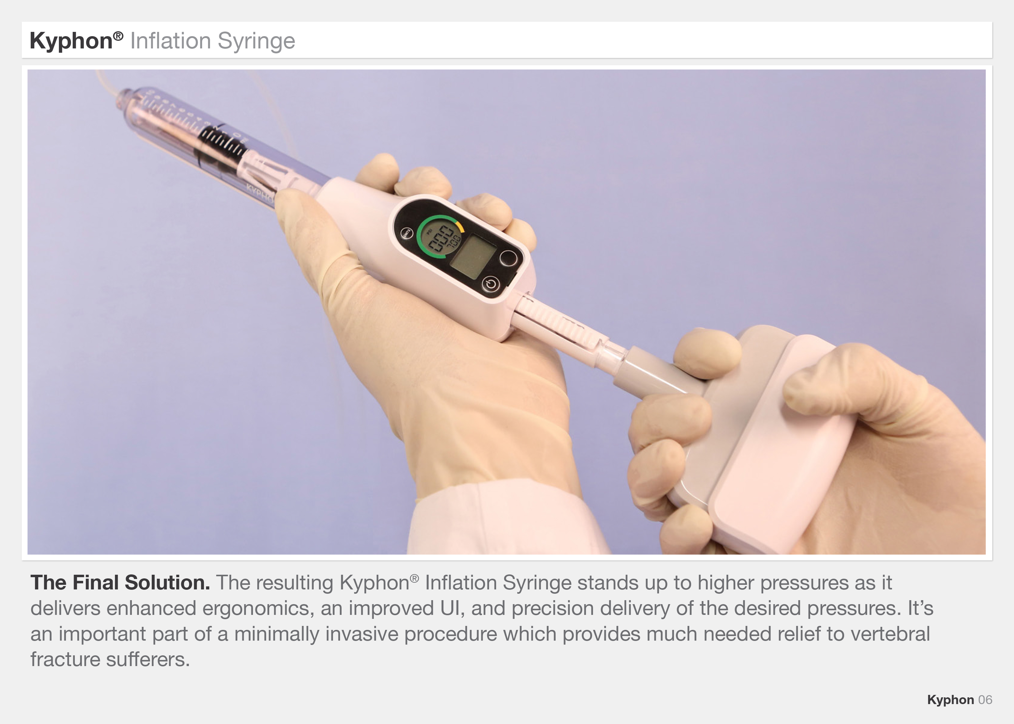 Medtronic Kyphon Inflation Syringe by Robert Hubler at